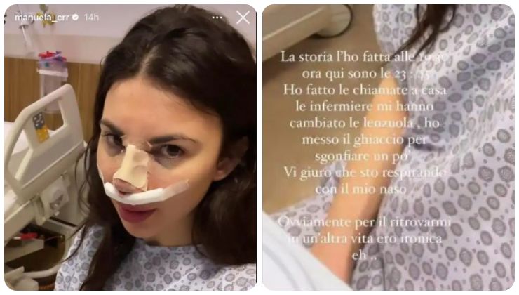 Manuela ha rifatto il naso